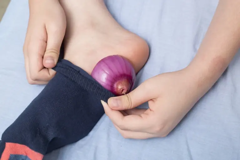 Cinque Notti con la Cipolla sui Talloni: Il Risultato Sorprendente per i Piedi Screpolati